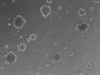 3D Culture of Human Primary Pulmonary Alveolar Epithelial Cell Spheroids