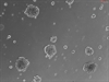 3D Culture of Human Primary Pulmonary Alveolar Epithelial Cell Spheroids