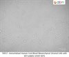 Immortalized Human Cord Blood Mesenchymal Stromal Cells with RFP (cbMSC-hTERT-RFP)