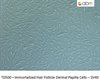Immortalized Hair Follicle Dermal Papilla Cells - SV40