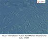 Immortalized Human Bone Marrow Mesenchymal Cells - hTERT