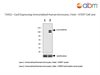Cas9 Expressing Immortalized Human Astrocytes, Fetal - hTERT Cell Line