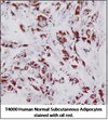 Human Primary Subcutaneous Adipocytes
