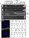 Human Endometrial Somatic Stem Cells (Epithelial Fraction hESP-ICEp)