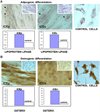 Human Endometrial Somatic Stem Cells (Stromal Fraction hESP-ICEs)