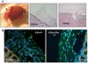 Human Endometrial Somatic Stem Cells (Stromal Fraction hESP-ICEs)